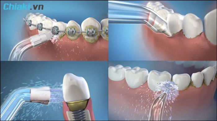 đọc kỹ hướng dẫn sử dụng máy tăm nước để đạt được nhiều lợi ích