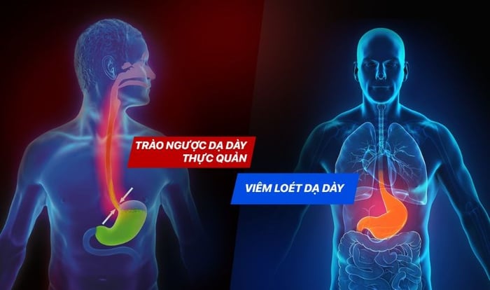 Người bị loét dạ dày và trào ngược dạ dày không thích hợp sử dụng chanh mật ong.