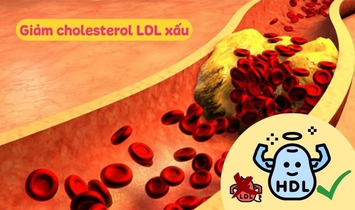 Lecithin hỗ trợ giảm cholesterol LDL xấu và tăng cholesterol HDL tốt trong cơ thể