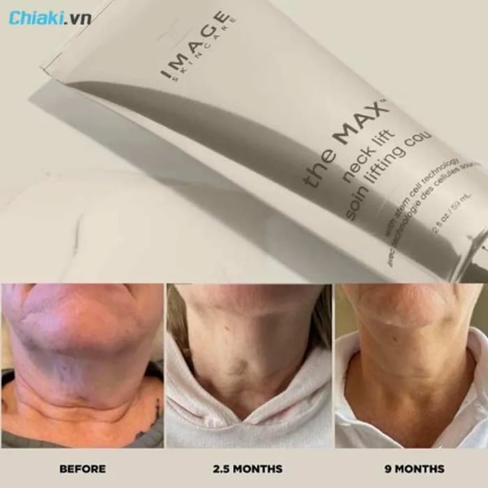 Đánh giá kem dưỡng da cổ Image The Max Neck Lift 