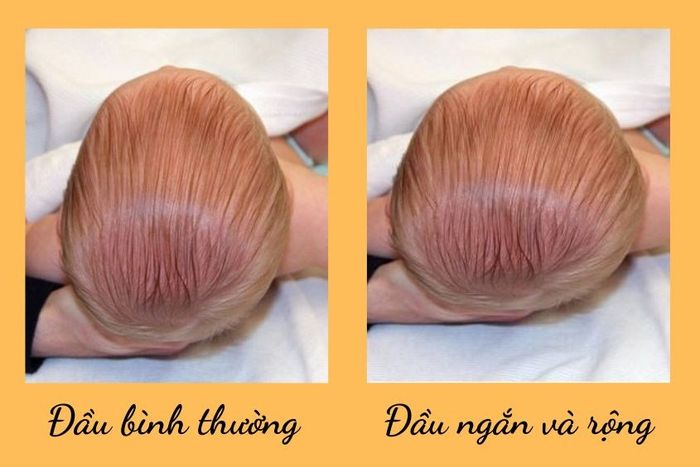 Bí quyết dân gian giúp trẻ sơ sinh khắc phục tình trạng méo đầu