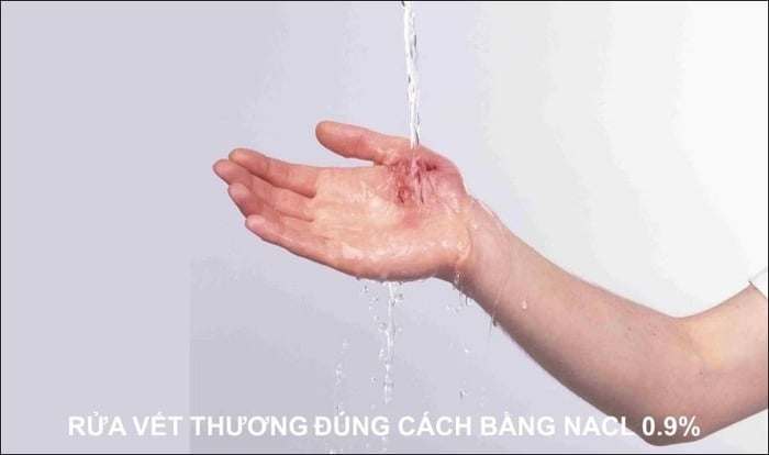 Rửa vết thương hở bằng nước muối