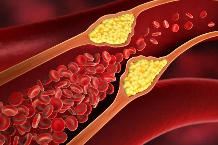 Thực đơn ăn dặm chay cho bé hỗ trợ hạ nồng độ cholesterol