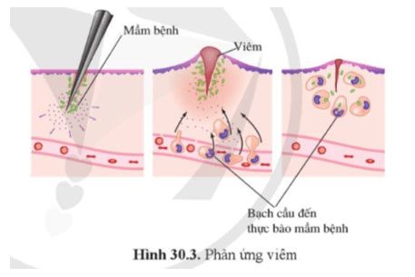 Hình vẽ 30.3