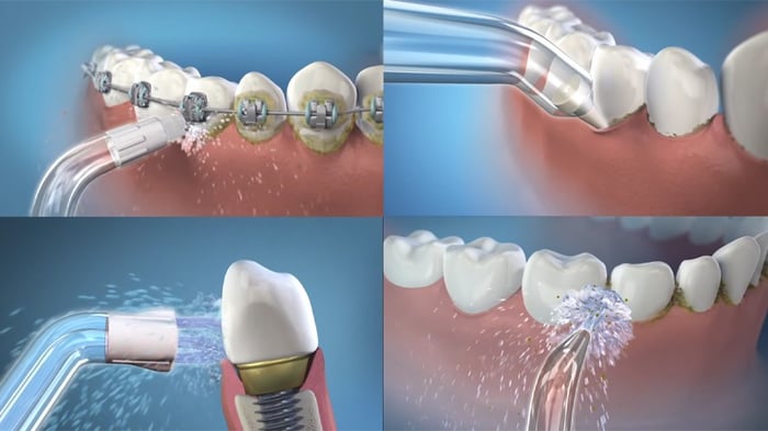 Lựa chọn máy tăm nước dựa trên chế độ phun và điều chỉnh áp lực