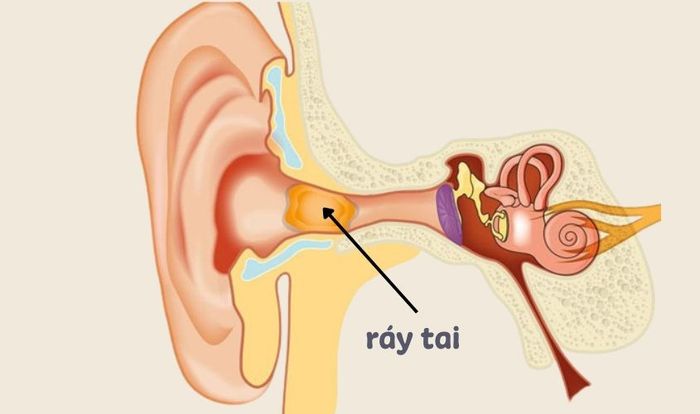 Cơ chế tự làm sạch của tai