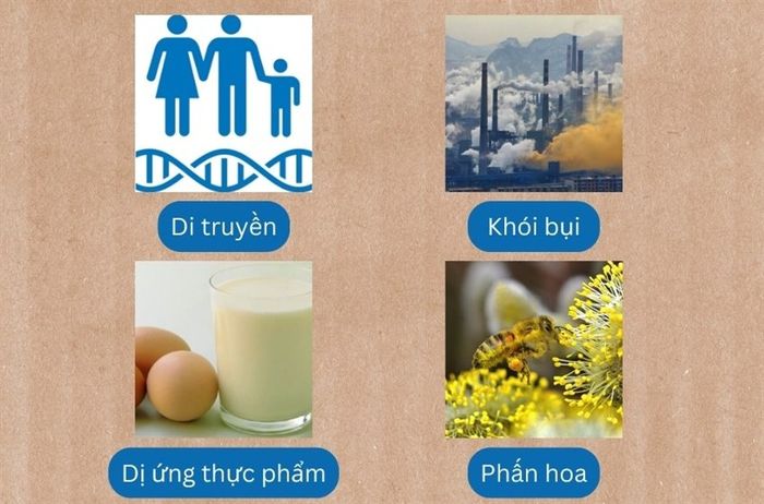 Trẻ sơ sinh mắc chàm sữa