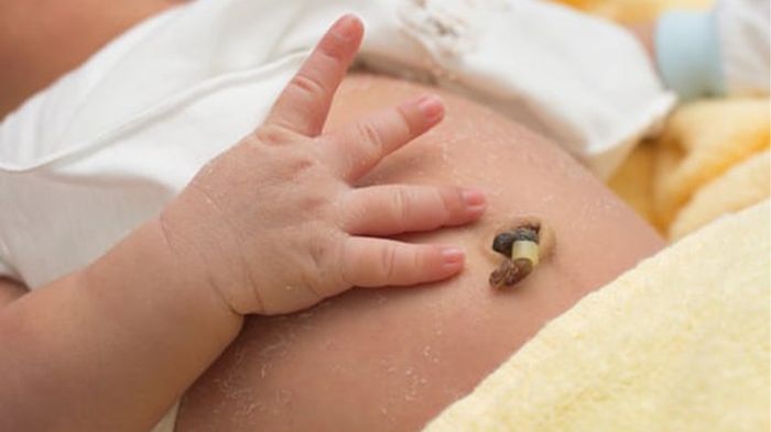 Cách chăm sóc rốn cho em bé sơ sinh sau khi tắm