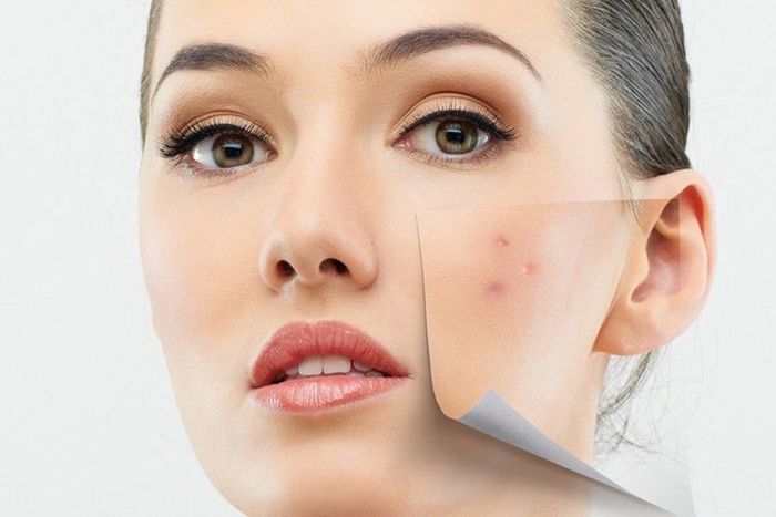 Sữa rửa mặt Acnes - Lựa chọn hàng đầu cho da mụn