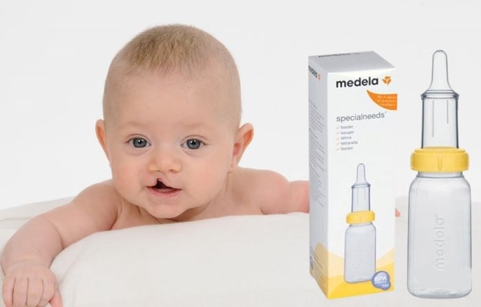 Bình sữa Medela dành cho trẻ sứt môi, hở hàm ếch