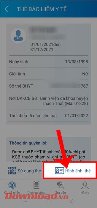 Chọn Hình ảnh thẻ