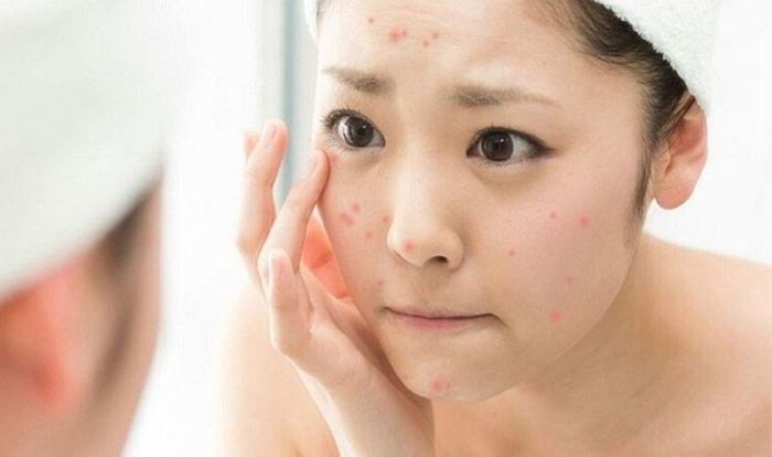 Sử dụng Niacinamide cùng AHA và BHA có thể gây kích ứng da