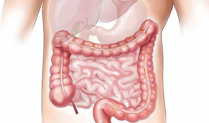 Sữa Ensure giả có thể gây ra ảnh hưởng đến gan và ruột