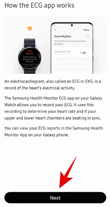 Cách ứng dụng ECG hoạt động trên Galaxy Watch