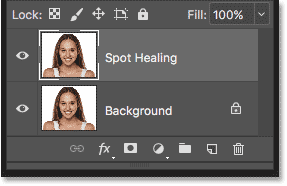 Chữa Cháy loại bỏ các vết thương trong Photoshop