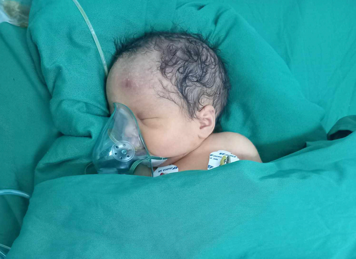 Bé Trần Văn Đạt đang được điều trị tại Bệnh viện Sản Nhi tỉnh Nghệ An. Ảnh được cung cấp bởi nhân vật