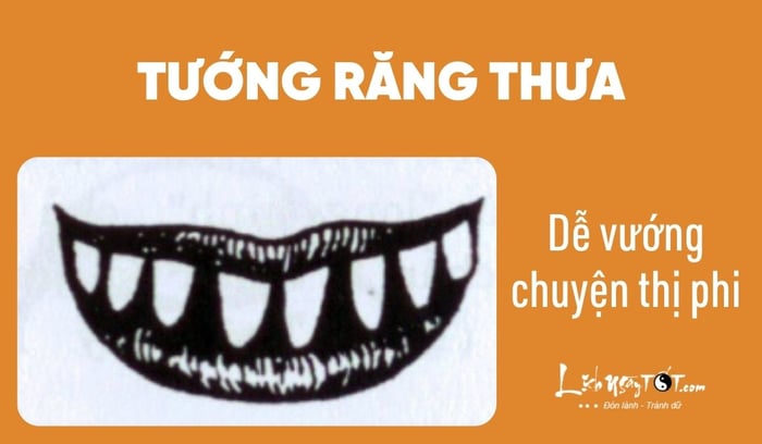 Xem tính cách qua tướng răng - Răng thưa