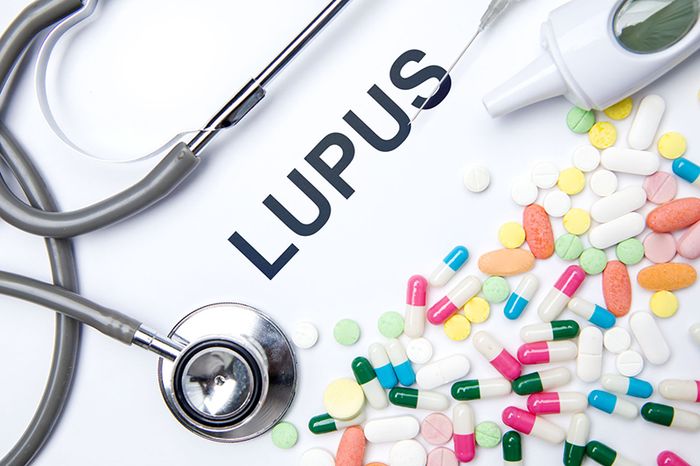 Cách điều trị Lupus ban đỏ khi có biến chứng phủ tạng thường gây nhiều tác dụng phụ, cần sự tư vấn cụ thể từ chuyên gia.