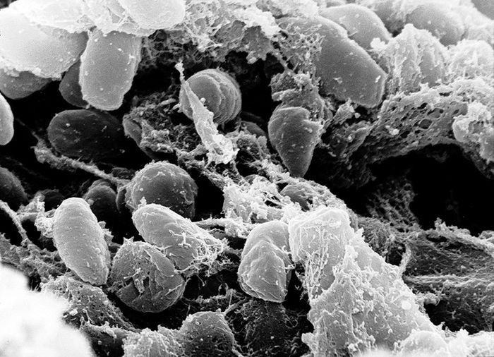 Tác nhân chủ yếu gây ra dịch hạch: Vi khuẩn Yersinia pestis