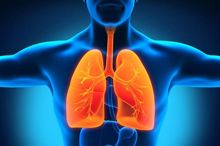 Sự tích tụ dịch trong túi khí của phổi có thể khiến người bệnh gặp khó khăn trong việc thở khi nằm