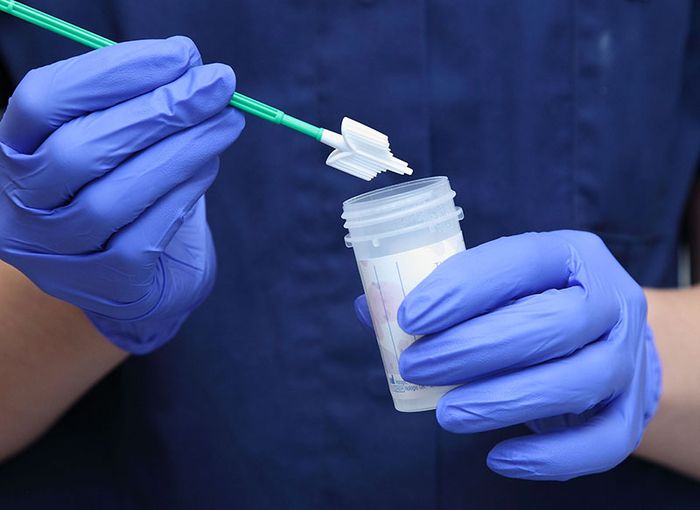 Xét nghiệm HPV là phương pháp phổ biến hiện nay dành cho phụ nữ từ 30 tuổi trở lên