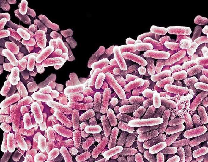 Vi khuẩn Salmonella Typhi là nguyên nhân gây ra bệnh thương hàn đường ruột với khả năng lây nhiễm cao