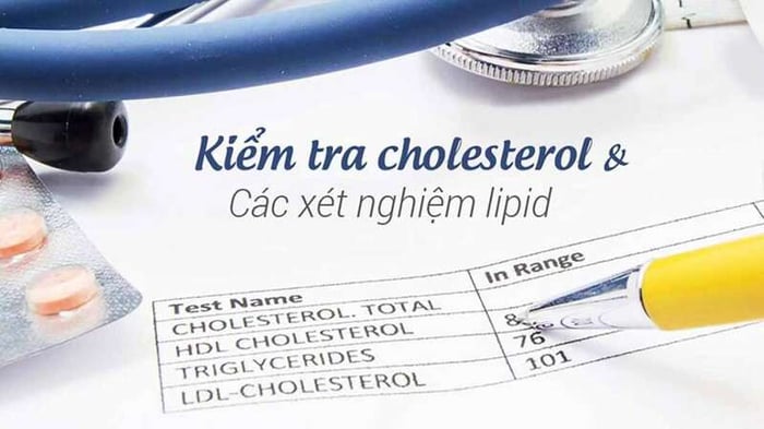 Kiểm tra Cholesterol giúp đánh giá nguy cơ mắc bệnh tim và đột quỵ