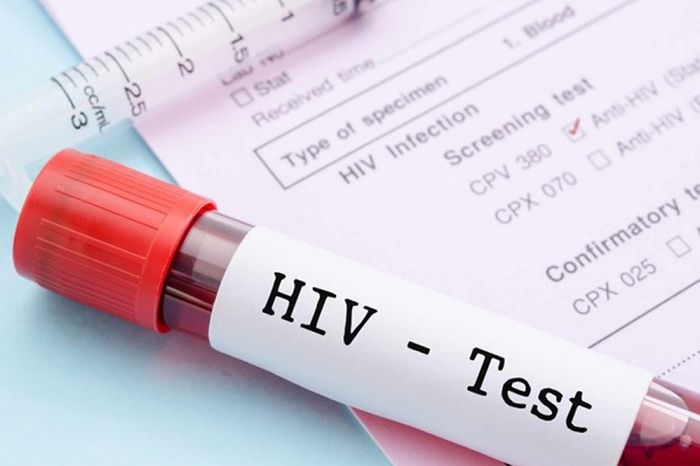 Việc tiến hành xét nghiệm HIV là cực kỳ quan trọng