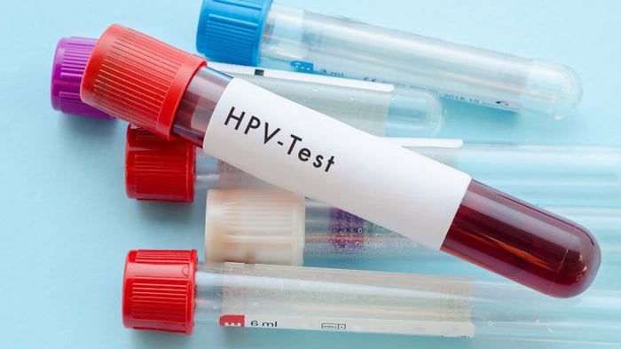 Hãy đi kiểm tra sức khỏe định kỳ để ngăn ngừa việc nhiễm HPV