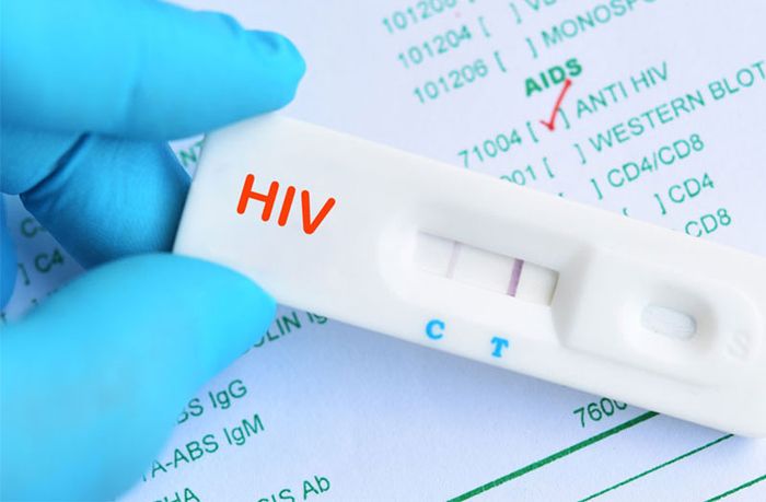 Nên thực hiện xét nghiệm HIV sớm khi có nghi ngờ về bị nhiễm bệnh