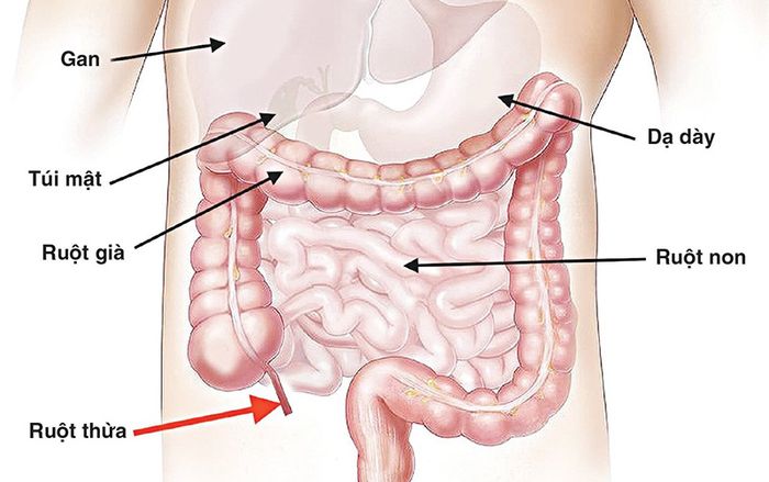 Đau ruột thừa ở bên nào là một câu hỏi phổ biến của nhiều người