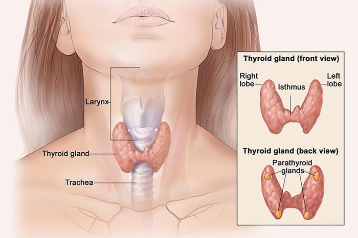 Viêm tuyến giáp De Quervain là tình trạng viêm tuyến giáp bán cấp ở dạng mô hạt thường gặp ở phụ nữ.