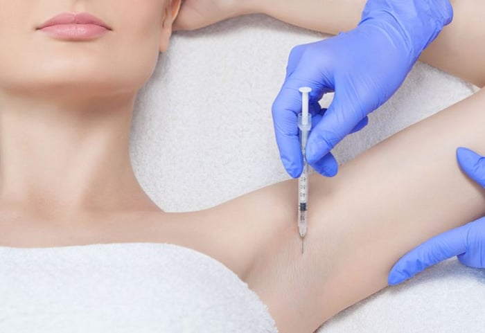 Các phương pháp như chiếu laser, phẫu thuật, tiêm botox,... có thể là giải pháp cho vấn đề hôi nách