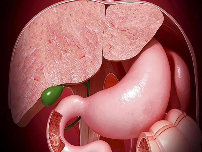 Polyp túi mật là một loại bệnh lành tính phổ biến hiện nay