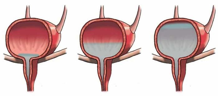 Chức Năng Dự Trữ Nước Tiểu Và Đào Thải Nước Tiểu Thông Qua Niệu Đạo