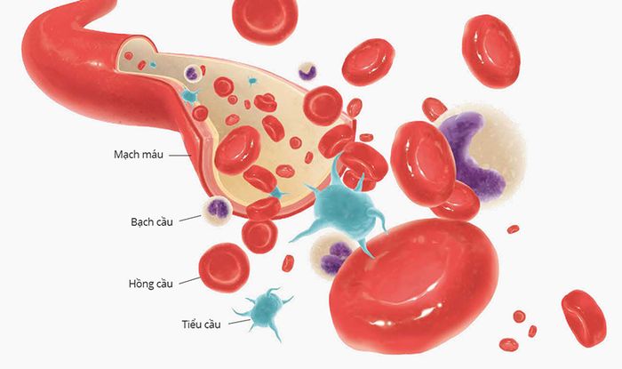 Thành phần của mạch máu và điều tra nguyên nhân giảm tiểu cầu
