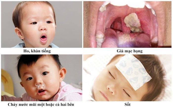 Vi khuẩn diphtheriae