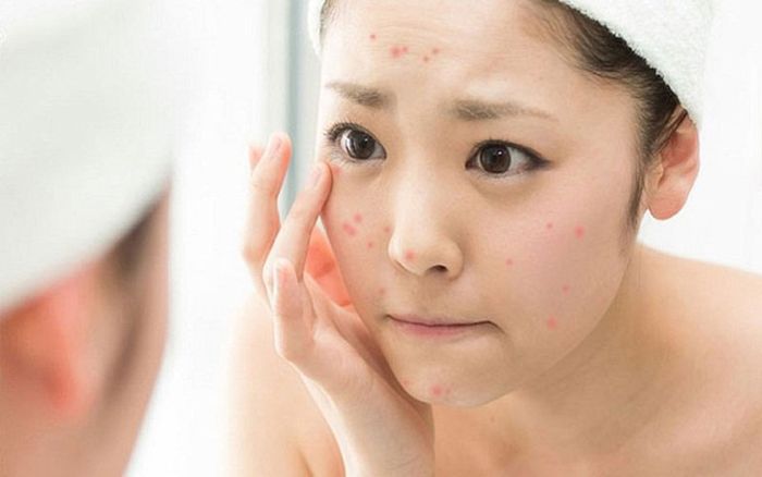 Phụ nữ có chu kỳ kinh nguyệt không đều cần kiểm tra Estrogen.