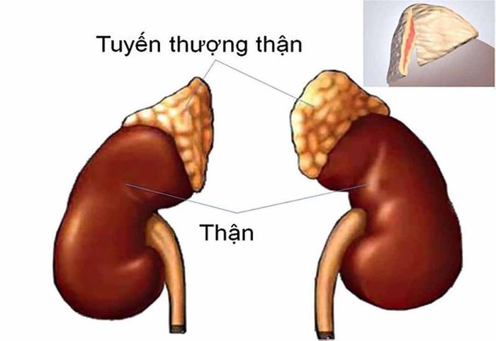 Sự tăng tiết aldosteron quá mức từ tuyến thượng thận có thể là nguyên nhân gây ra hội chứng Conn