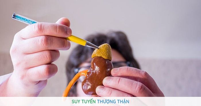 Suy tuyến thượng thận là một bệnh phổ biến