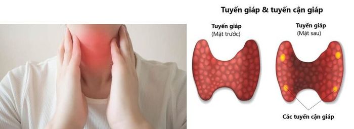 Nguyên nhân gây tăng nồng độ hormone của tuyến cận giáp