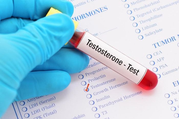 Testosterone là một trong những xét nghiệm không thể thiếu khi thực hiện khám nội tiết