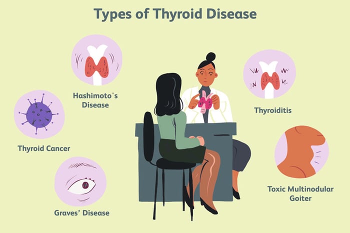 Bệnh lý liên quan đến tuyến giáp có nhiều dạng