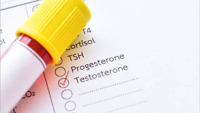Khám phá về xét nghiệm hormone cho phụ nữ.