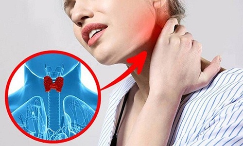 Sự tăng của hormone tuyến giáp có thể gây ra đau mỏi ở cổ vai gáy.