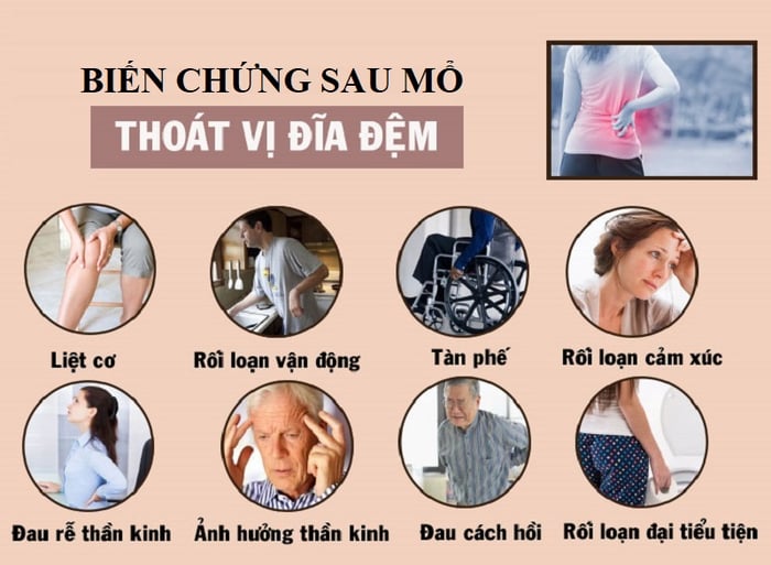 Địa chỉ phẫu thuật thoát vị đều ảnh hưởng đến việc giảm thiểu các biến chứng sau mổ.