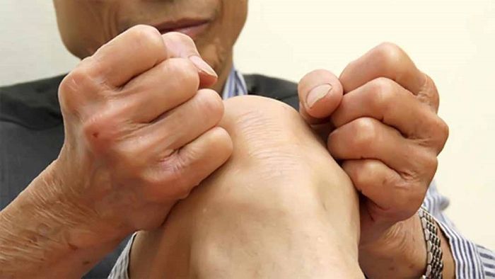 Bệnh giả Gout: Nguy cơ không nên xem nhẹ