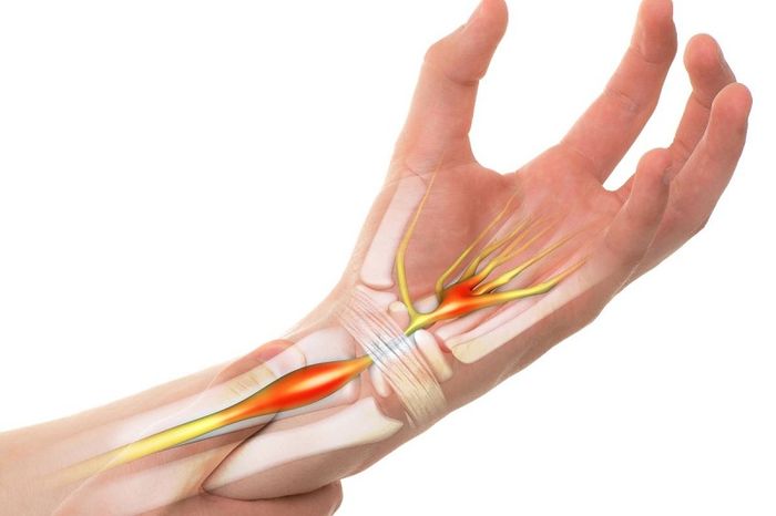 Tê chân tay thường xuyên là dấu hiệu của bệnh gì?