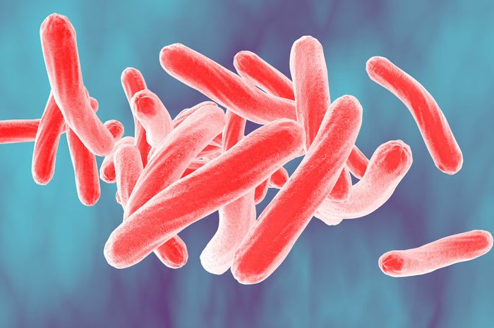 Trực khuẩn Mycobacterium tuberculosis là nguyên nhân gây bệnh lao xương khớp