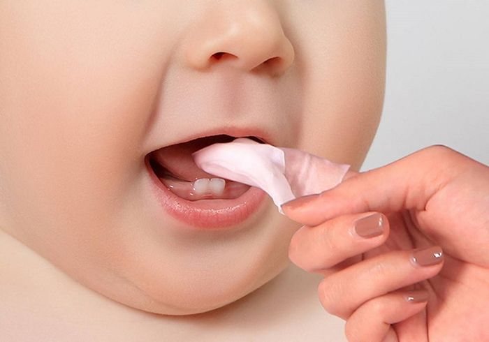 Phương pháp chính để điều trị nấm miệng ở trẻ là sử dụng thuốc
